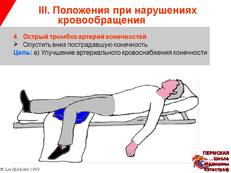 III. Положения при нарушениях   кровообращения © Lev Subbotin 1999